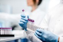 Scientist putting test tubes into a holder in a lab.