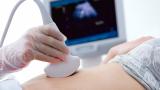 Woman having an ultrasound scan.