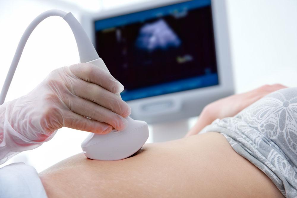 Woman having an ultrasound scan.